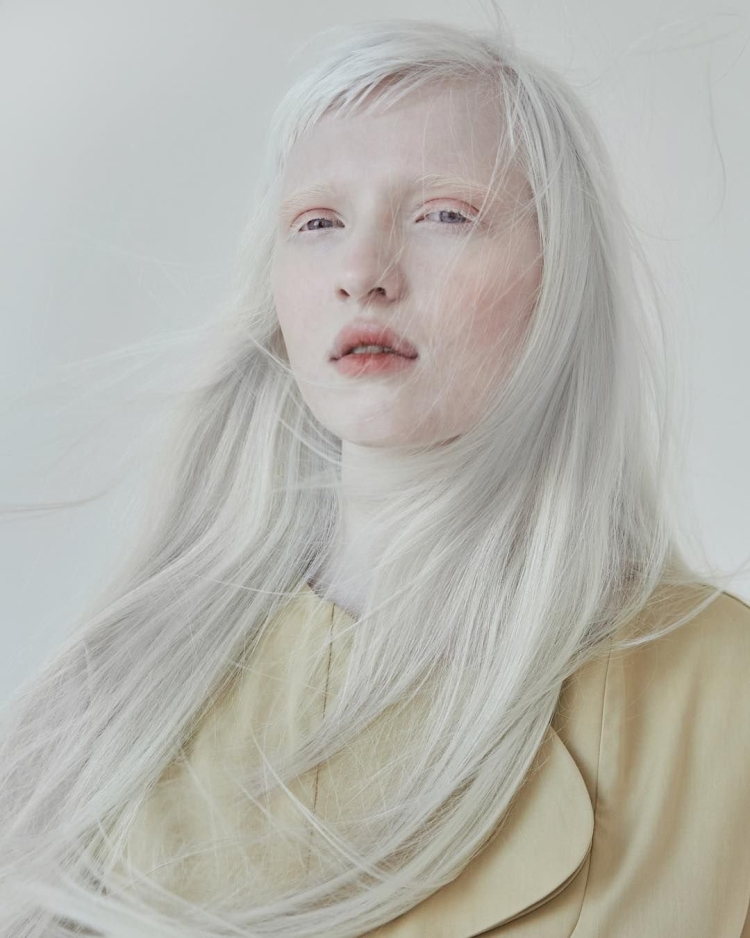 Саша Смирнов альбинос