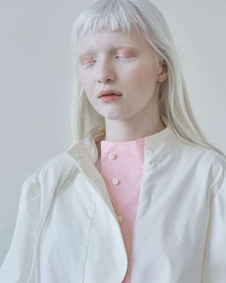 Давид Манукян альбинос