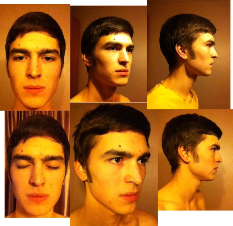 Медитерранид фенотип