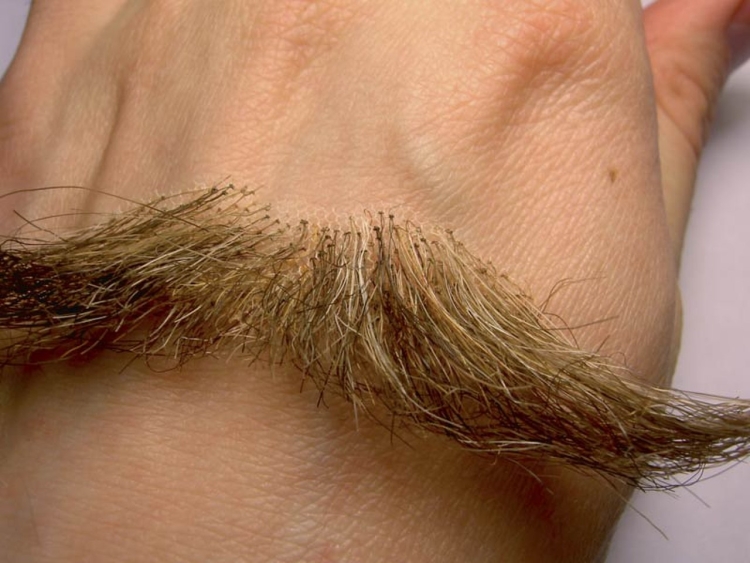 Лобковые волосы у женщин