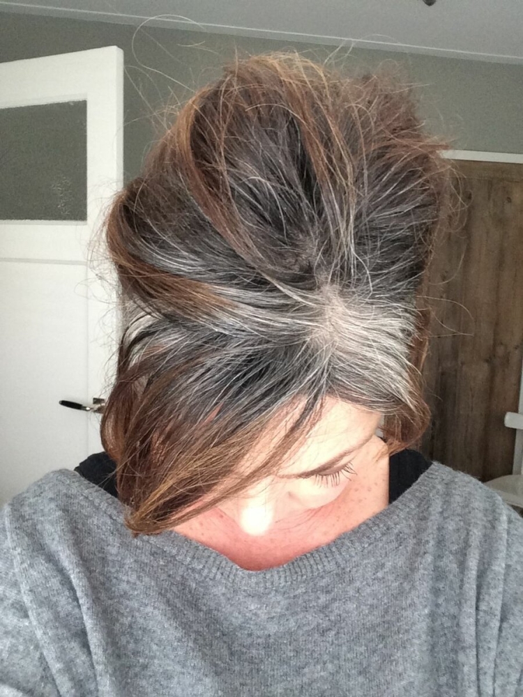 Частичная Седина