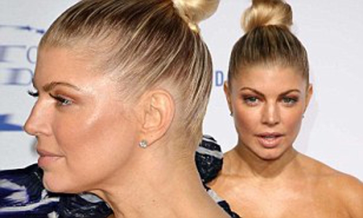 Фёрджи лысеет