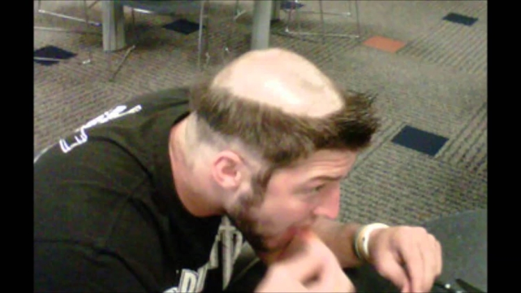 Выбритая макушка