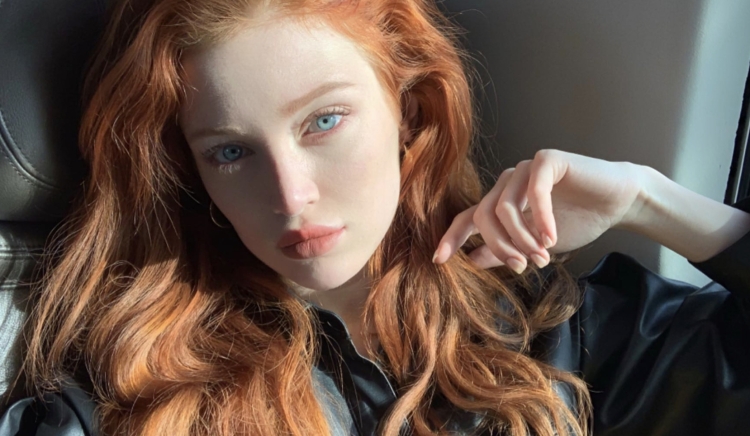 Супермодели с веснушками