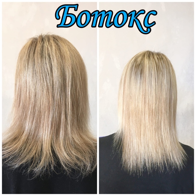 Ботокс с прикорневым объемом