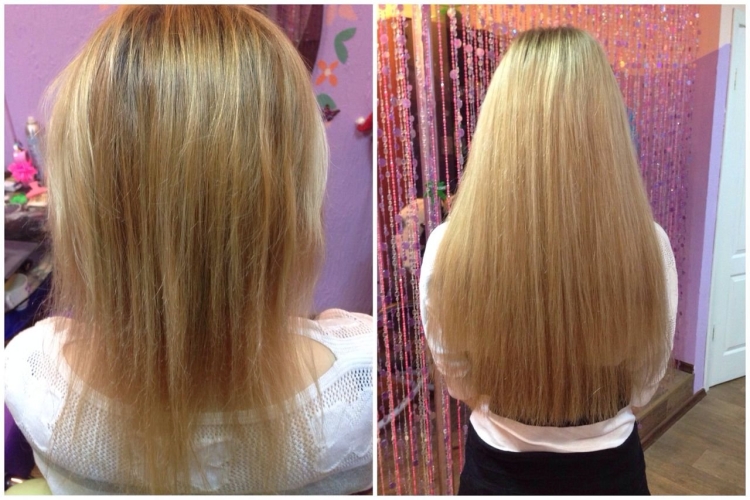 Густые волосы до и после