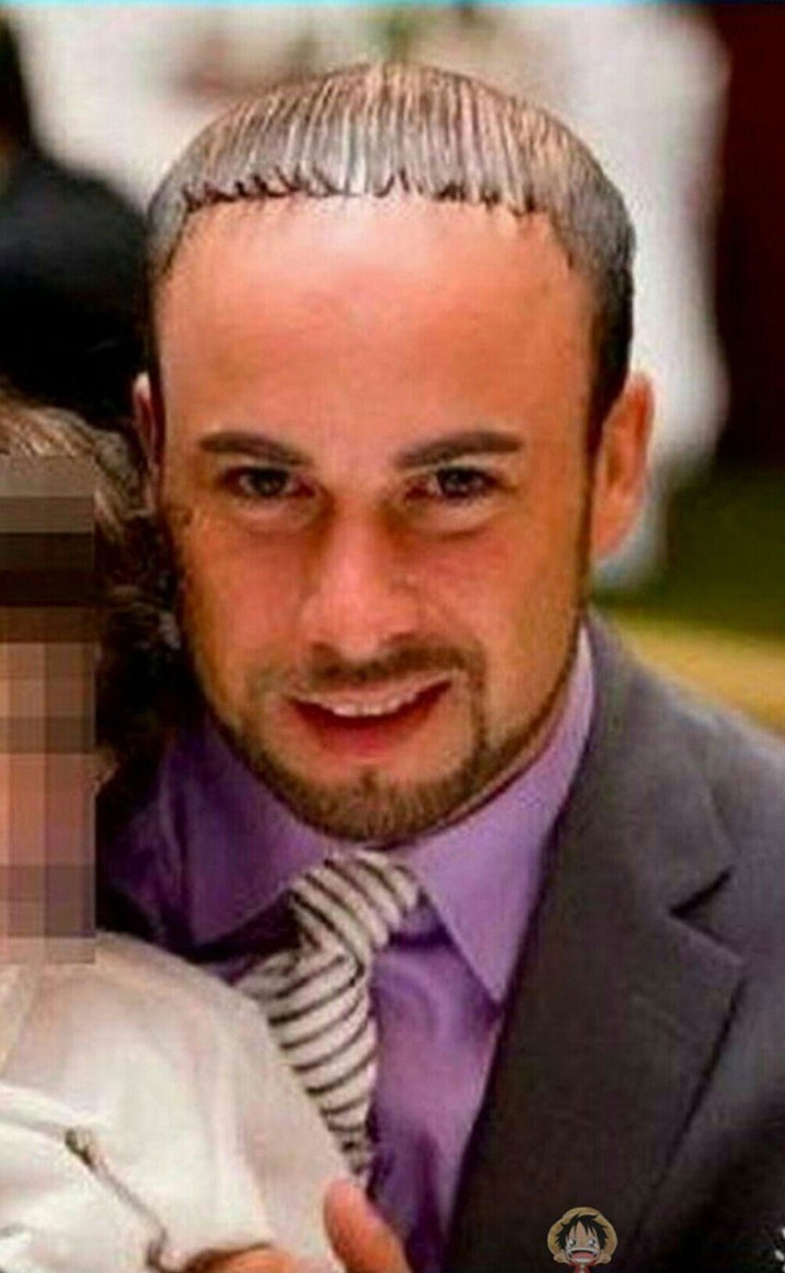 Прически с лысиной