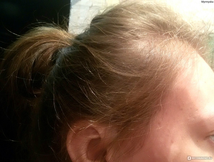 Крысиный хвост на голове