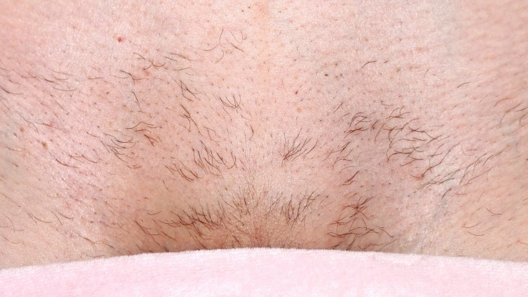 Оволосение женского лобка