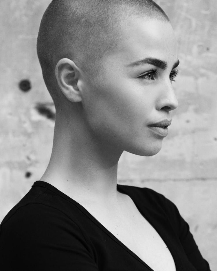 Керри уэллис лысая