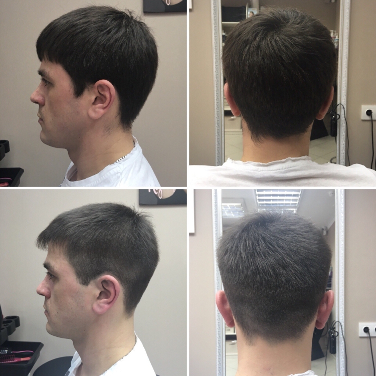 Мужская стрижка шапочка вид сзади