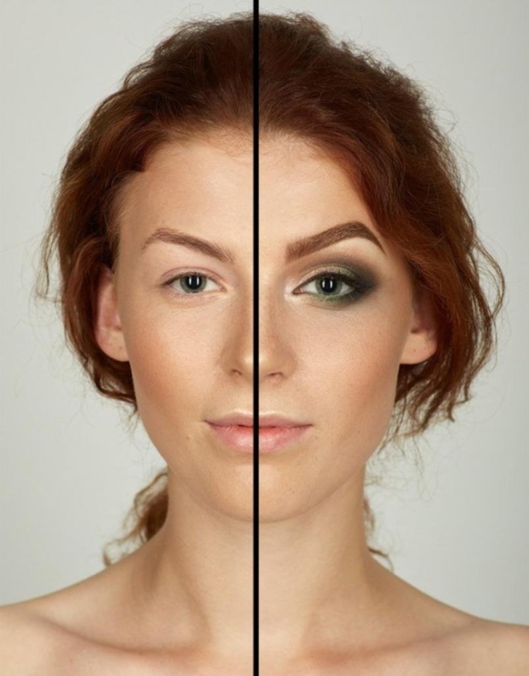 Асимметрия бровей