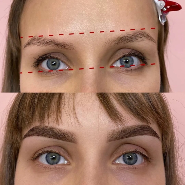 Исправление асимметрии бровей