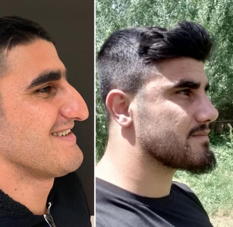 Ахмет Дилбер пластический хирург