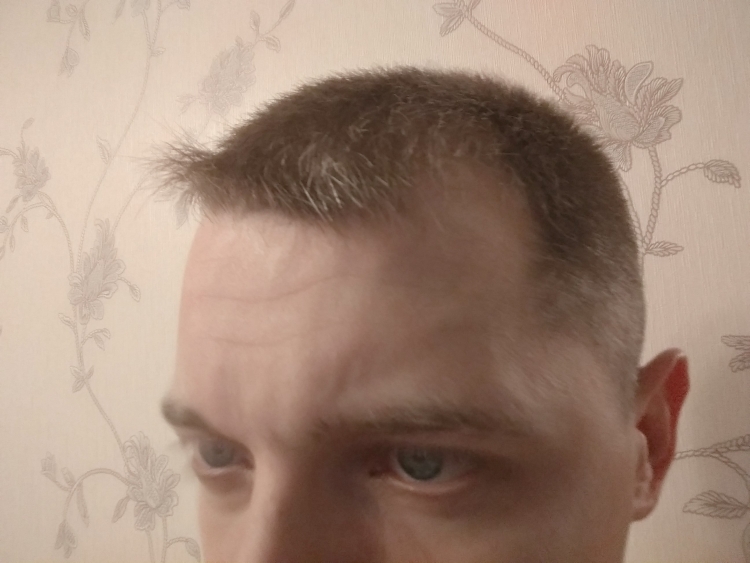 Вихор на челке