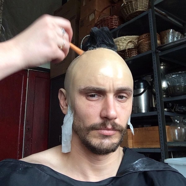 Длинные волосы с лысиной