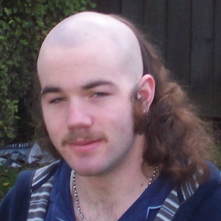 Длинные волосы с лысиной