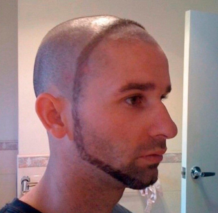 Прическа лысая по бокам