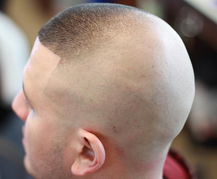 Саутсайд фейд