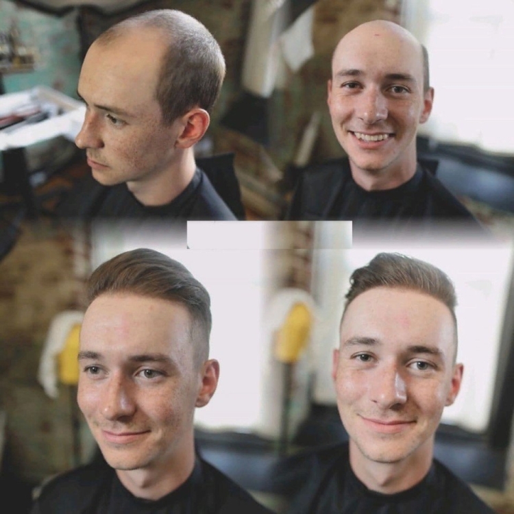 Стрижка налысо мужская до и после