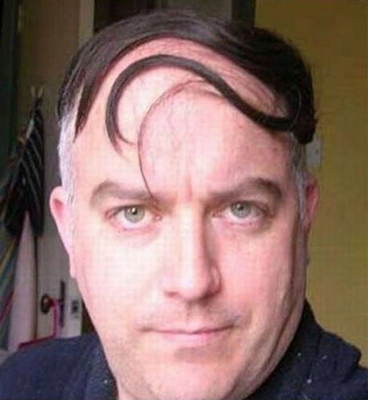 Прически с лысиной