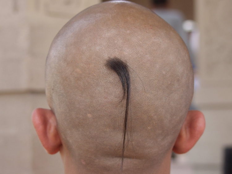 Лысина по середине