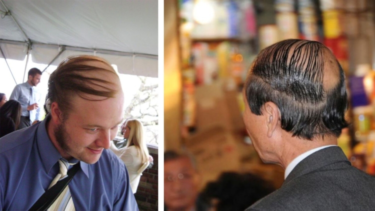 Мужчина волосы зачесаны на лысину