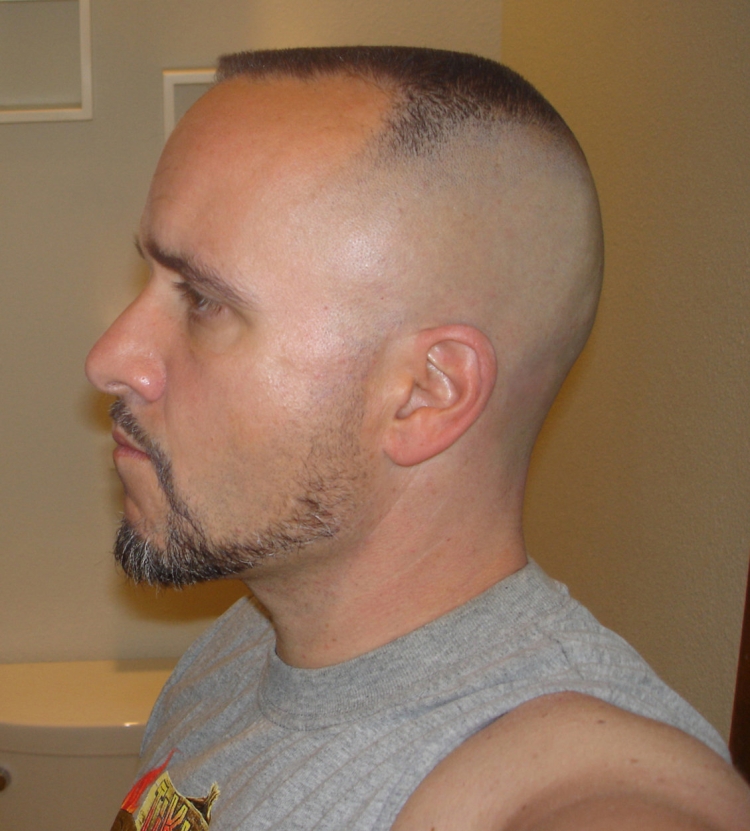 Фейд для лысеющих