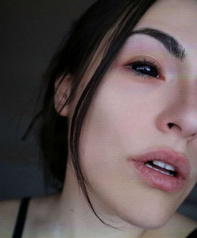 Склеры черные