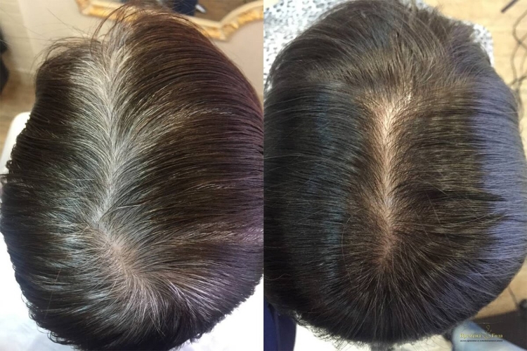 Закрашивание седины на темных волосах