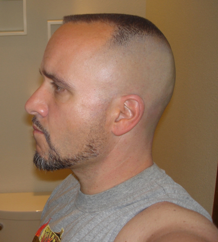 Фейд для лысеющих