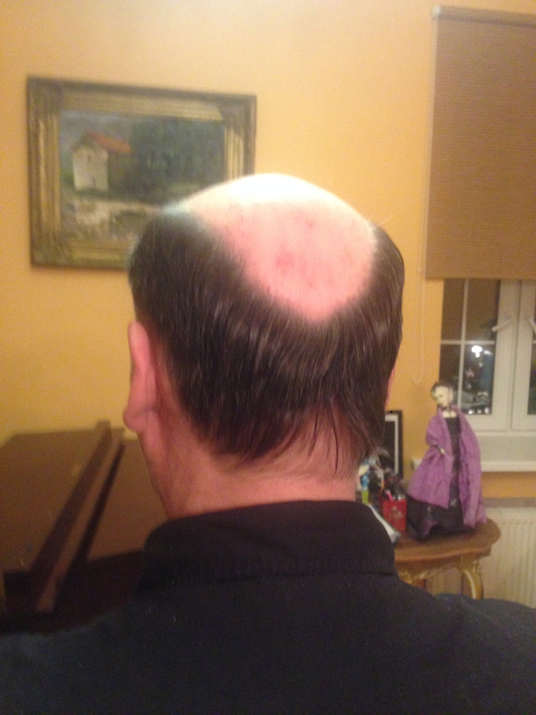 Мужские стрижки с лысиной на макушке