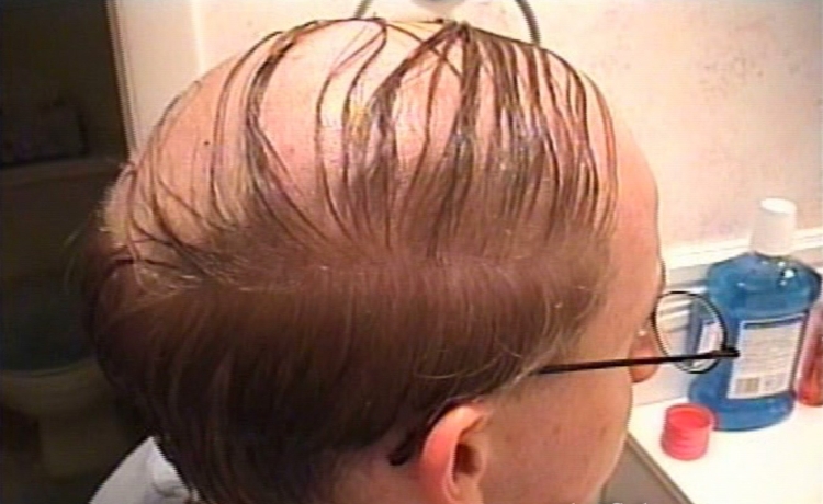 Волосы зализанные на лысину